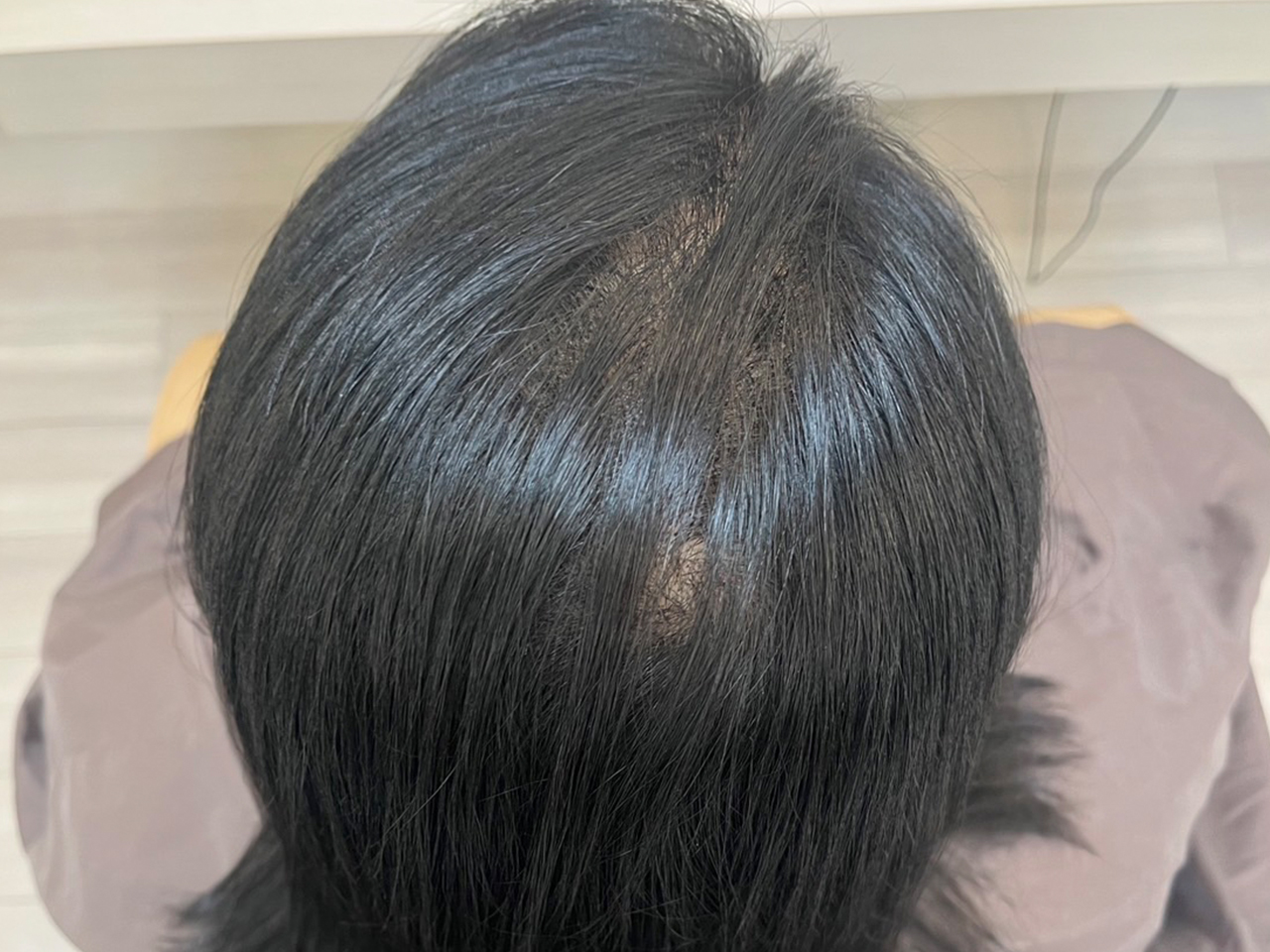 After