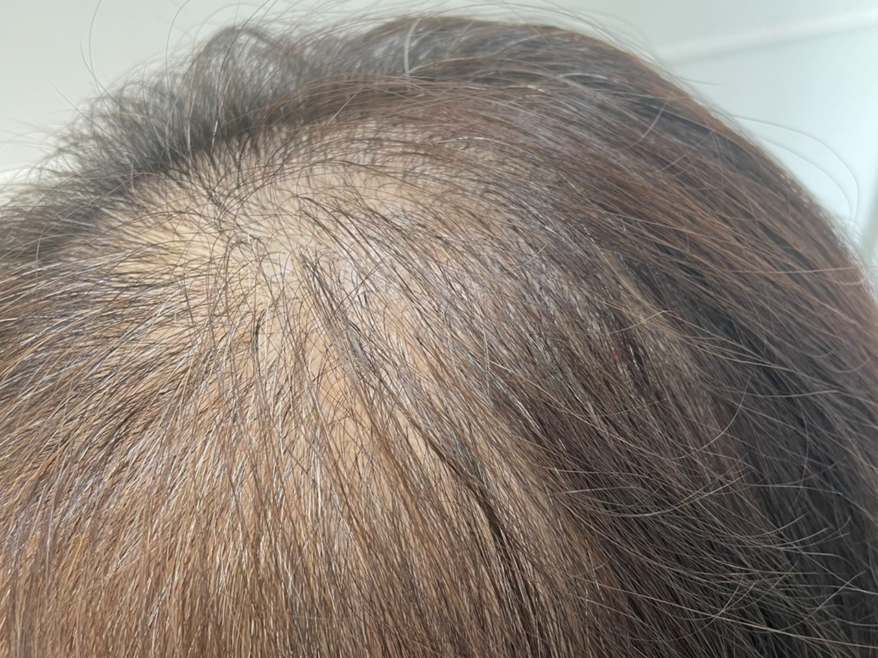 Before